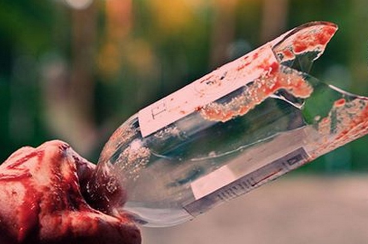 Arona: 20enne di Divignano aggredito con un coccio di bottiglia in via Torino