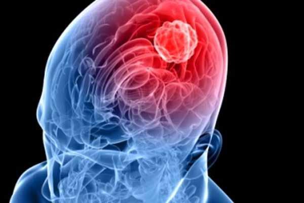 A Maggiora il primo caso di meningite nel Novarese