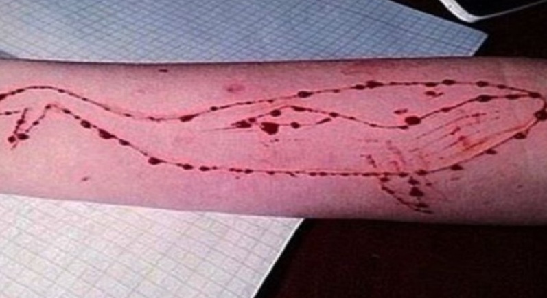 Blue whale: arriva il decalogo della polizia