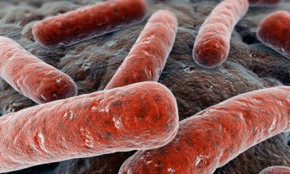 Un caso di tubercolosi in una scuola di Novara