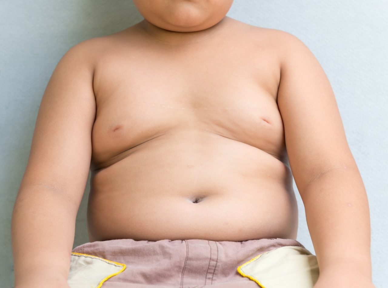 Nel 2022 più bambini obesi che sottopeso