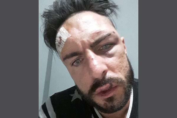 Aggressione in zona stazione a Novara