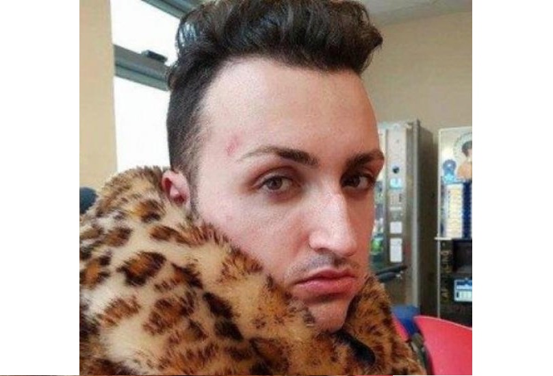 Aggredito Kevin Cagnardi, ghemmese, ex Grande Fratello