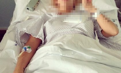 Emergenza scabbia all'ospedale di Ciriè: stop ai ricoveri