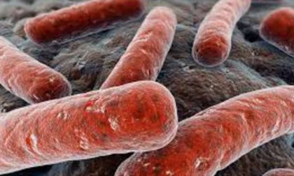 Tubercolosi due casi all'Avogadro di Torino