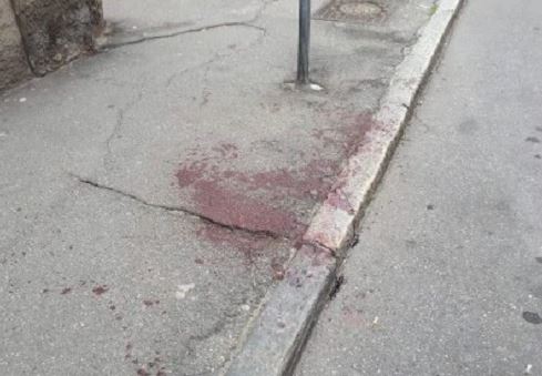 Spacca vetrina e si ferisce una mano