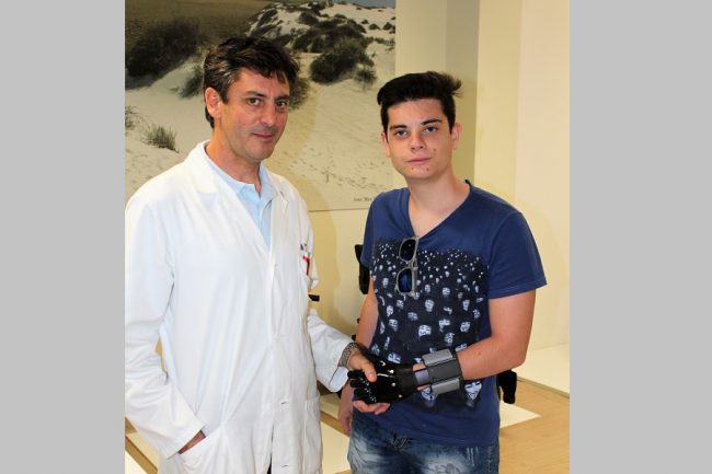 Protesi bionica alla mano per un giovane vercellese: primo caso in Italia