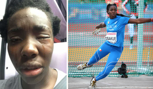 Daisy Osakue: chi è l’atleta colpita in viso da lancio di uova