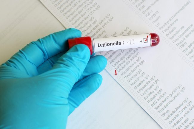 Epidemia Legionella: due morti in Lombardia