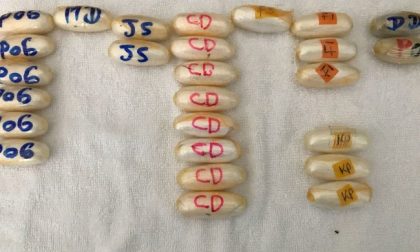 Corrieri della droga: arrestate due donne, avevano ingerito 133 ovuli IL VIDEO