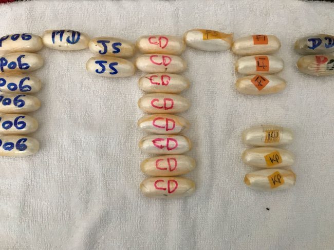 Corrieri della droga: arrestate due donne, avevano ingerito 133 ovuli IL VIDEO