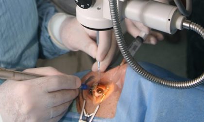 Operate di cataratta quattro donne perdono un occhio a Torino