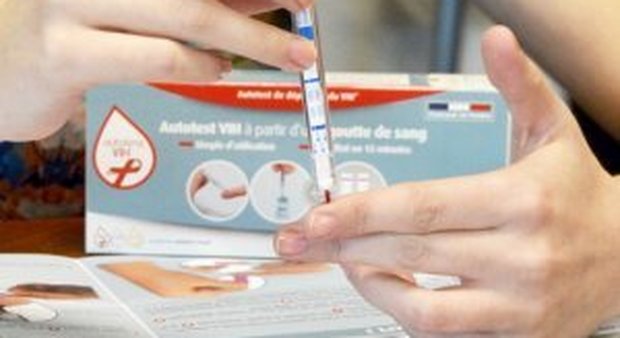 Hiv, Open Day con test gratuito al Maggiore