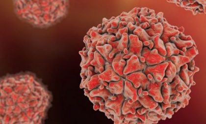 Caso di simil polio a Pavia: colpito bambino di 6 anni