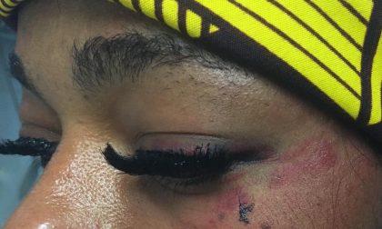 Aggressione omofoba a Novara: nessuno ha aiutato la donna picchiata