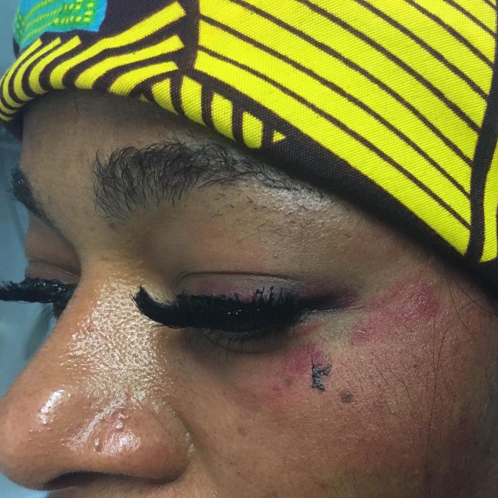 Aggressione omofoba a Novara: nessuno ha aiutato la donna picchiata