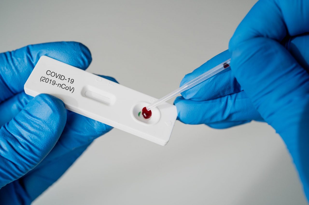 Tamponi rapidi a pagamento oggi e domani negli hotspot dell’Asl