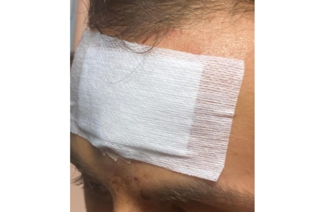 Violenza in carcere: detenuto lancia un pentolino in fronte ad un agente