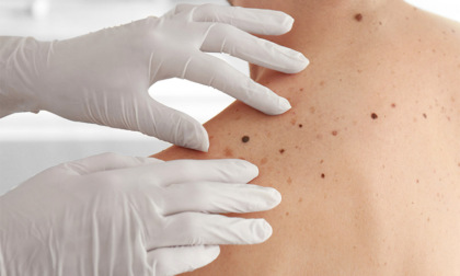 Novara dermatologa No Vax al lavoro nonostante la sospensione: beccata dai Nas