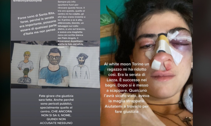 Picchiata nei bagni della discoteca per aver difeso il fidanzato: pubblica l’identikit degli aggressori