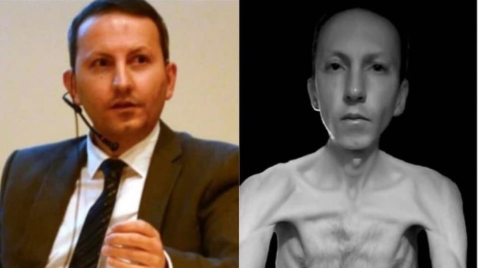 Ahmadreza Djalali colpito da infarto nel carcere di Evin: Amnesty lancia l’allarme