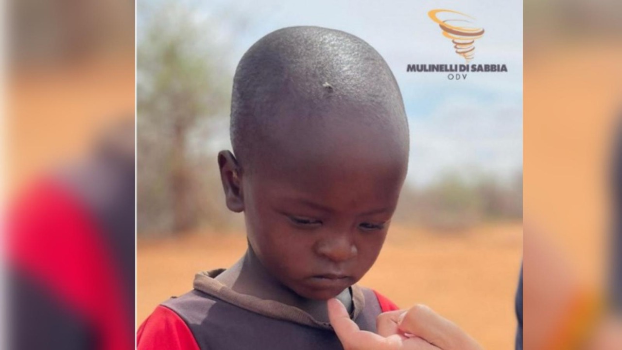 “Save Dylan”: da Oleggio parte l’appello per aiutare un bimbo keniota